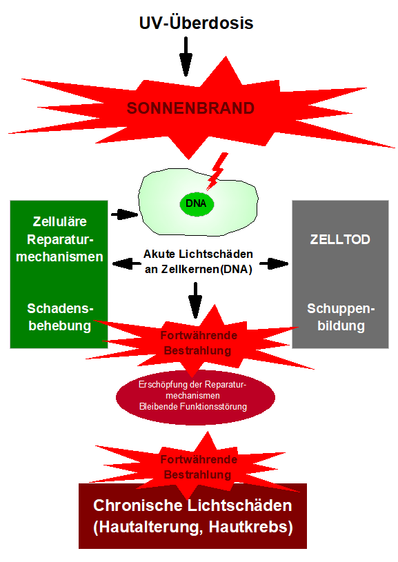 Sonnenbrand