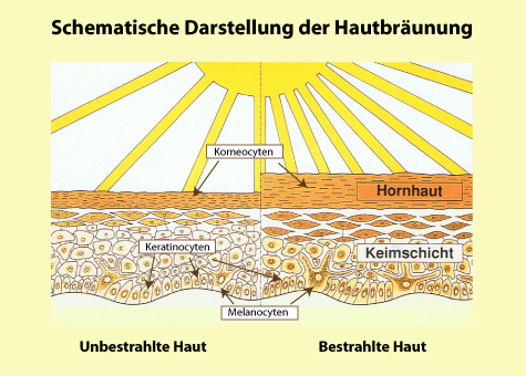 Haut-Hautbr-unung